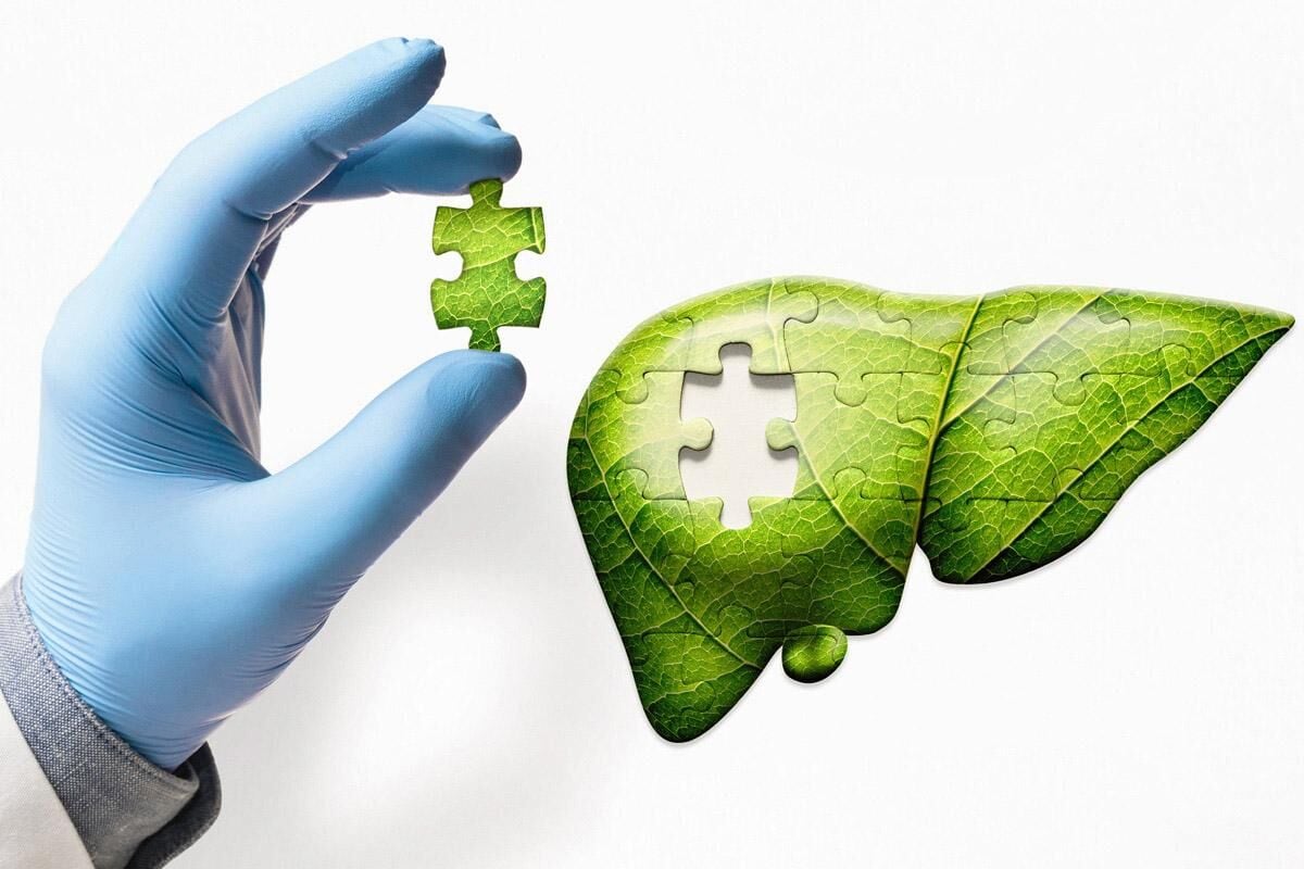 KLİNİK YAKLAŞIMLA HEPATOSTEATOZ VE METABOLİK SENDROM YÖNETİMİNDE RASYONEL FİTOTERAPİ